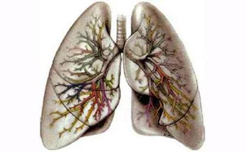 慢阻肺饮食要注意什么 慢阻肺的饮食注意什么