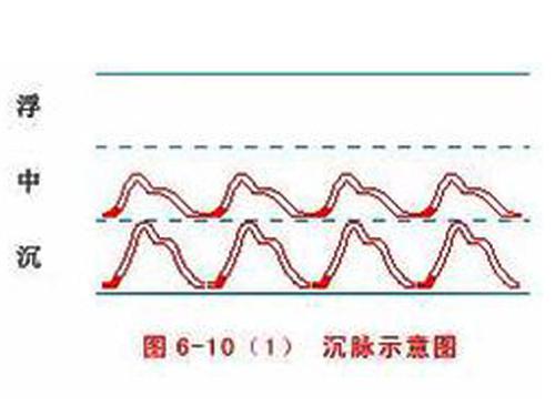 脉象沉是什么意思 什么叫脉象沉细