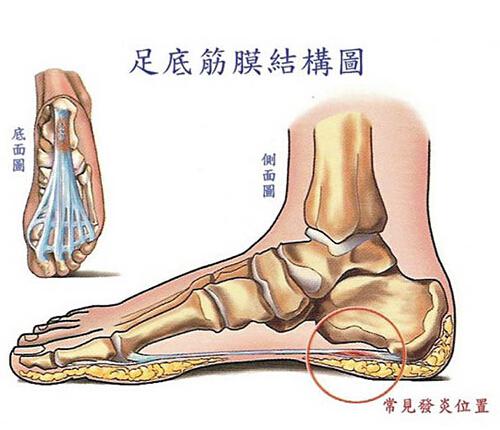 脚跟底部疼是怎么回事（脚跟底部痛是怎么回事）