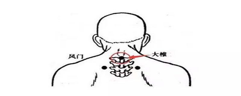 大椎的位置在哪里（大椎在什么位置怎么找）