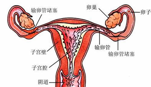 输卵管堵塞的表现 输卵管堵塞有什么样症状