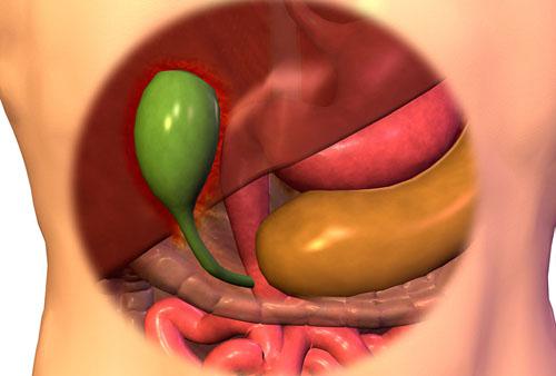 急性胆囊炎是怎么引起的 急性胆囊炎如何引起的