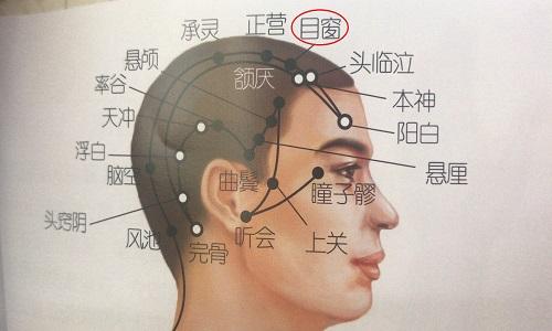 目窗的准确位置图 目窗的准确位置图图解