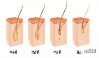 激光脱毛注意事项 5天内不要饮酒