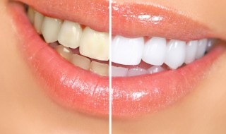 爱护牙齿的好方法有哪些 如何爱护牙齿