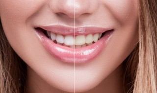 正确的牙齿增白方法（正确的牙齿增白方法是什么）