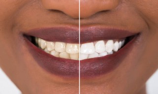 如何掌握两个洁白牙齿的小技巧 两颗洁白的牙齿