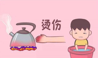 烫伤如何处理（烫伤后应该怎么办）