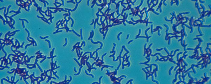 碘能否杀弧菌，弧菌是什么 聚维酮碘能杀弧菌吗