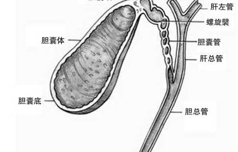 胆结石不能吃什么食物 胆囊炎胆结石不能吃什么食物