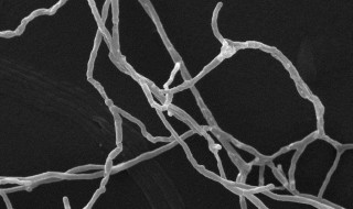 菌丝体与子实体有什么不同 菌丝和子实体区别
