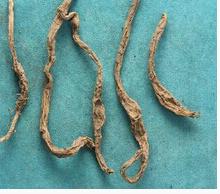 黄花菜根的功效与作用 黄花菜根的功效与作用及禁忌