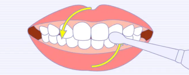 圆弧刷牙法（圆弧刷牙法步骤图）