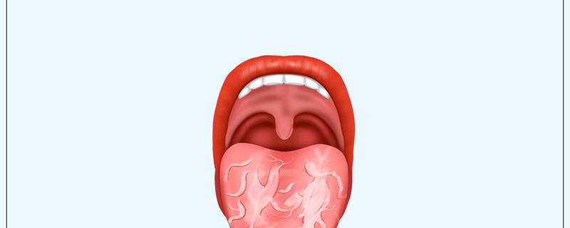舌苔有裂纹是怎么回事 小孩子舌苔有裂纹是怎么回事