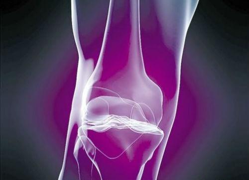 关节炎怎么治疗 膝盖关节炎怎么治疗