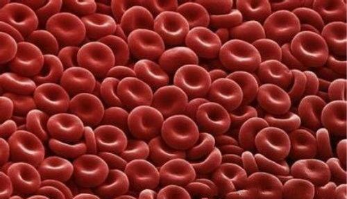红细胞压积 红细胞压积偏高