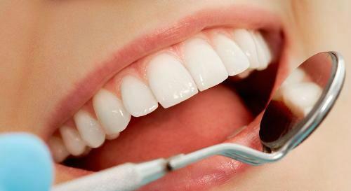 牙结石的偏方 牙结石的偏方怎么治疗