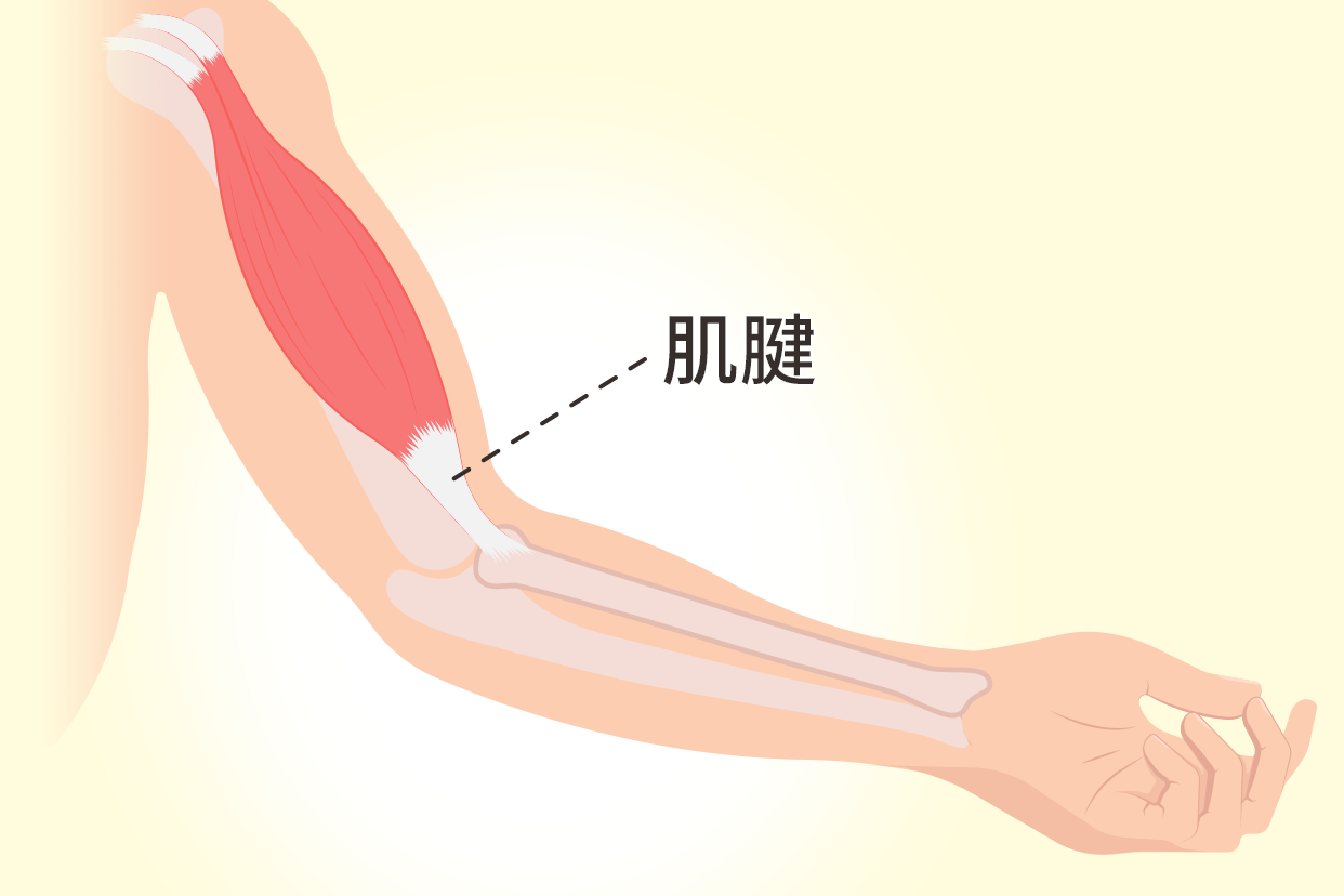 肌腱和韧带的区别图片 肌腱与韧带的区别图片
