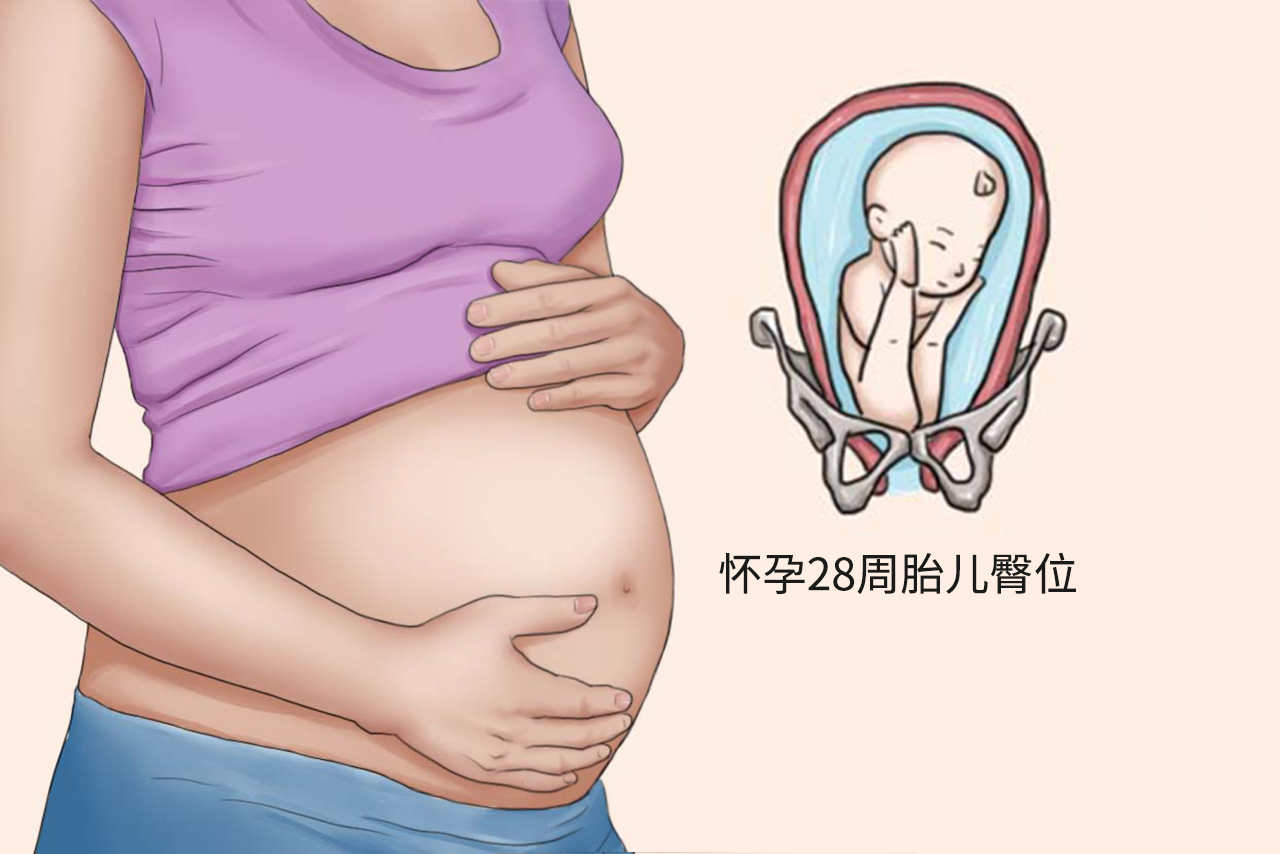 怀孕28周胎儿臀位图片（怀孕28周胎位臀位）