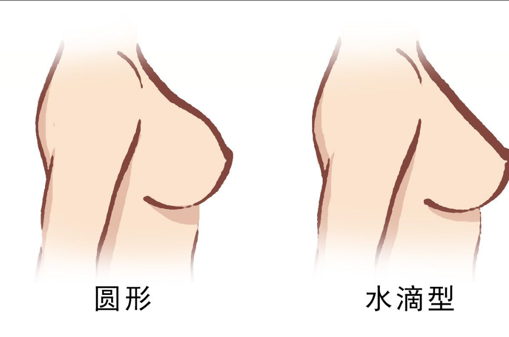 隆胸水滴好和圆形对比效果图 隆胸半圆形和水滴型