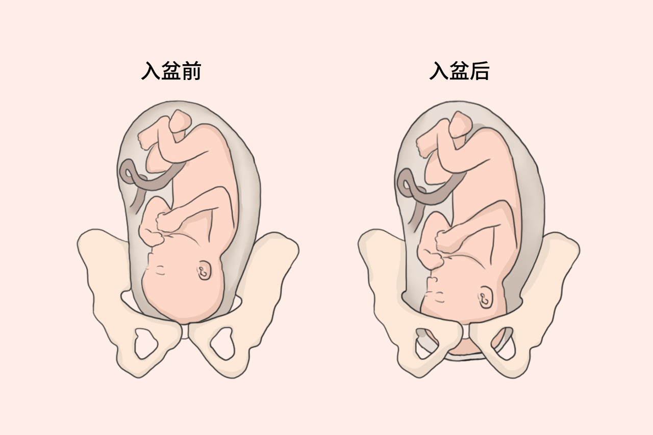 怀孕36周胎儿入盆图（怀孕36周图片是怎样的,小孩子入盆）