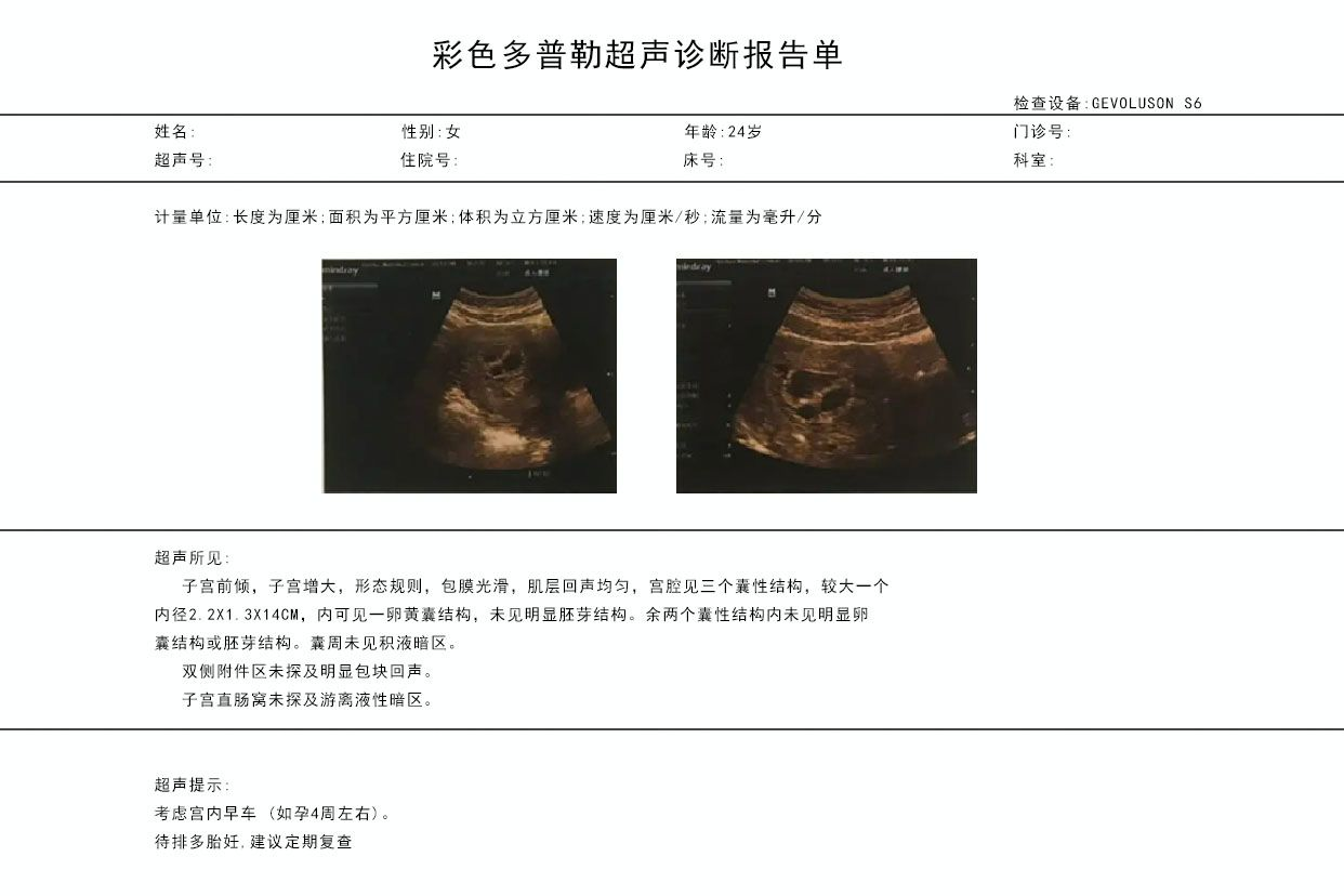 怀孕4周的彩超图片