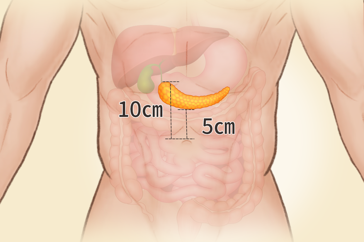 胰腺体表投影区位置图 胰腺体位置图片