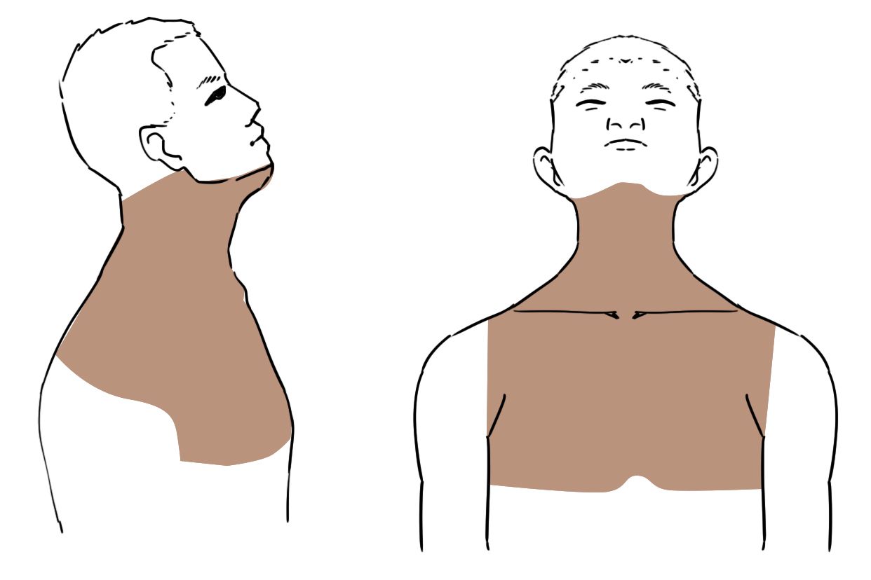 颈部手术消毒范围示意图（颈部手术消毒范围示意图图片）