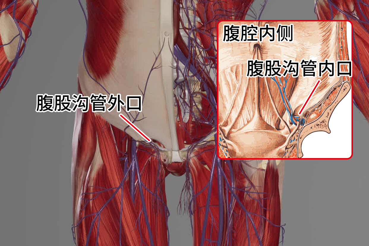 腹股沟内外环口示意图 腹股沟内环口位置图片