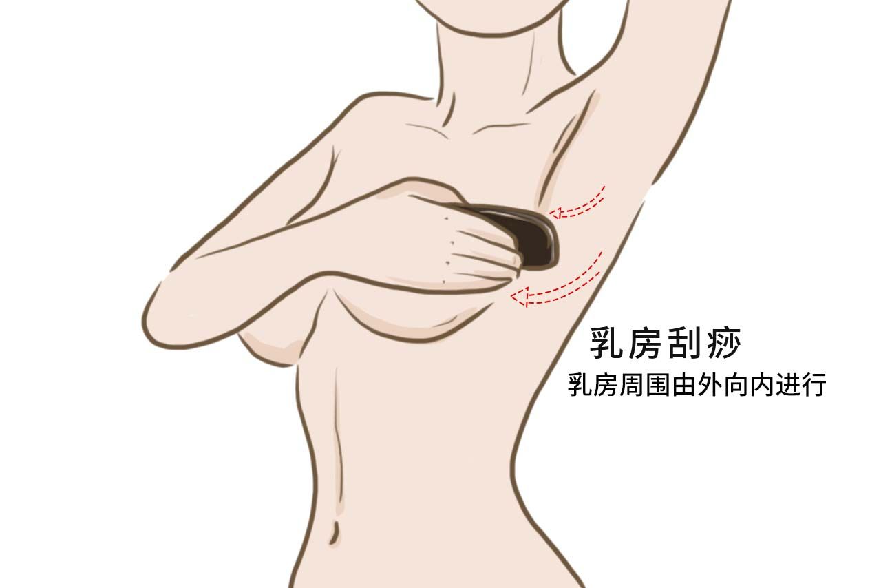 乳房刮痧图解 乳腺的刮痧手法图