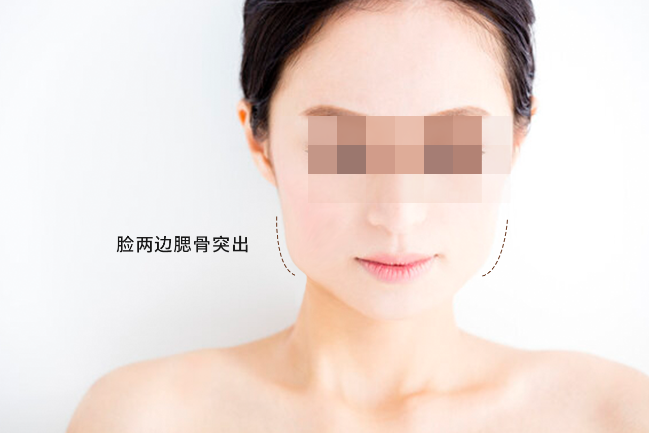 女人脸两边腮骨突出图片 女人脸两边腮骨突出图片