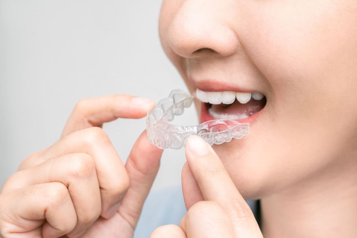 牙釉质透明照片（牙釉质透明照片图片）