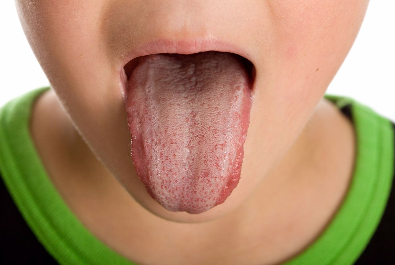 舌头上两边两条竖线图片 舌头中间两条竖线