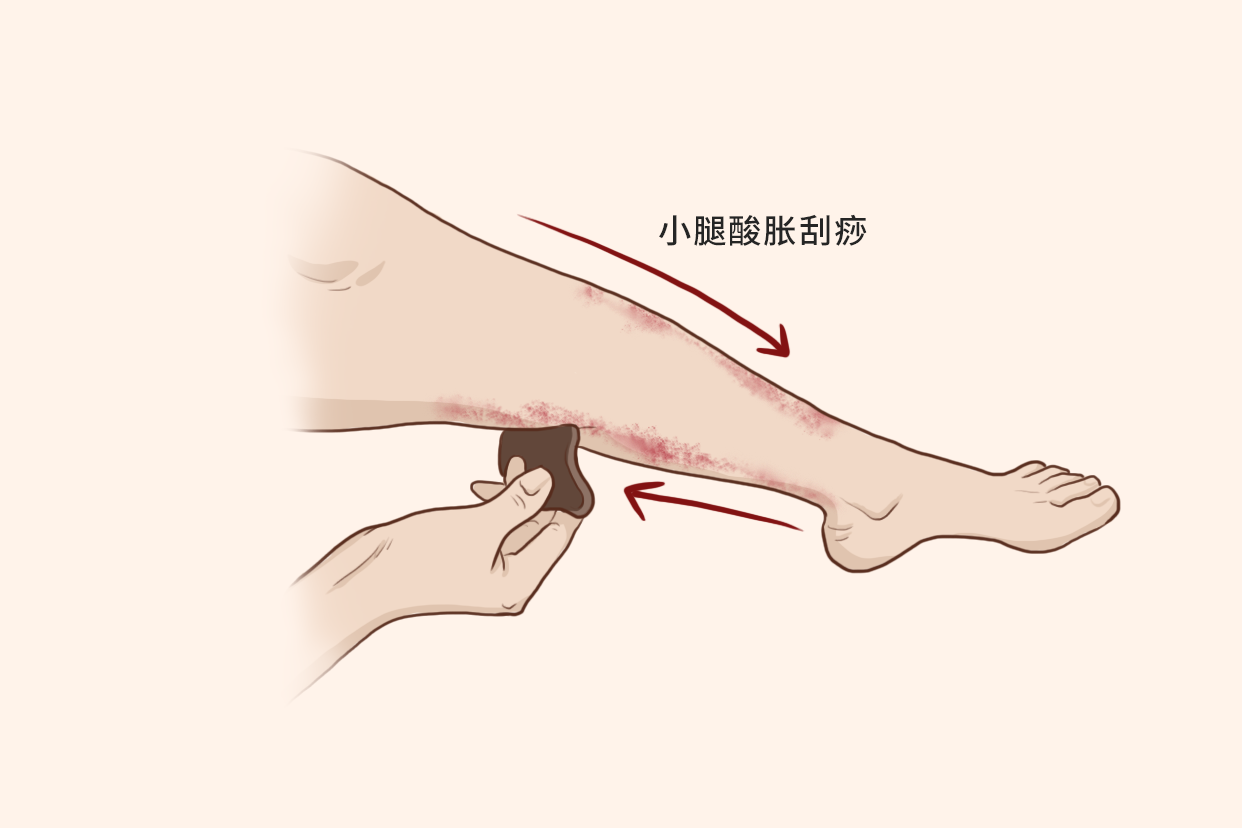 小腿酸胀刮痧的方法示意图（刮痧后小腿酸是怎么回事）