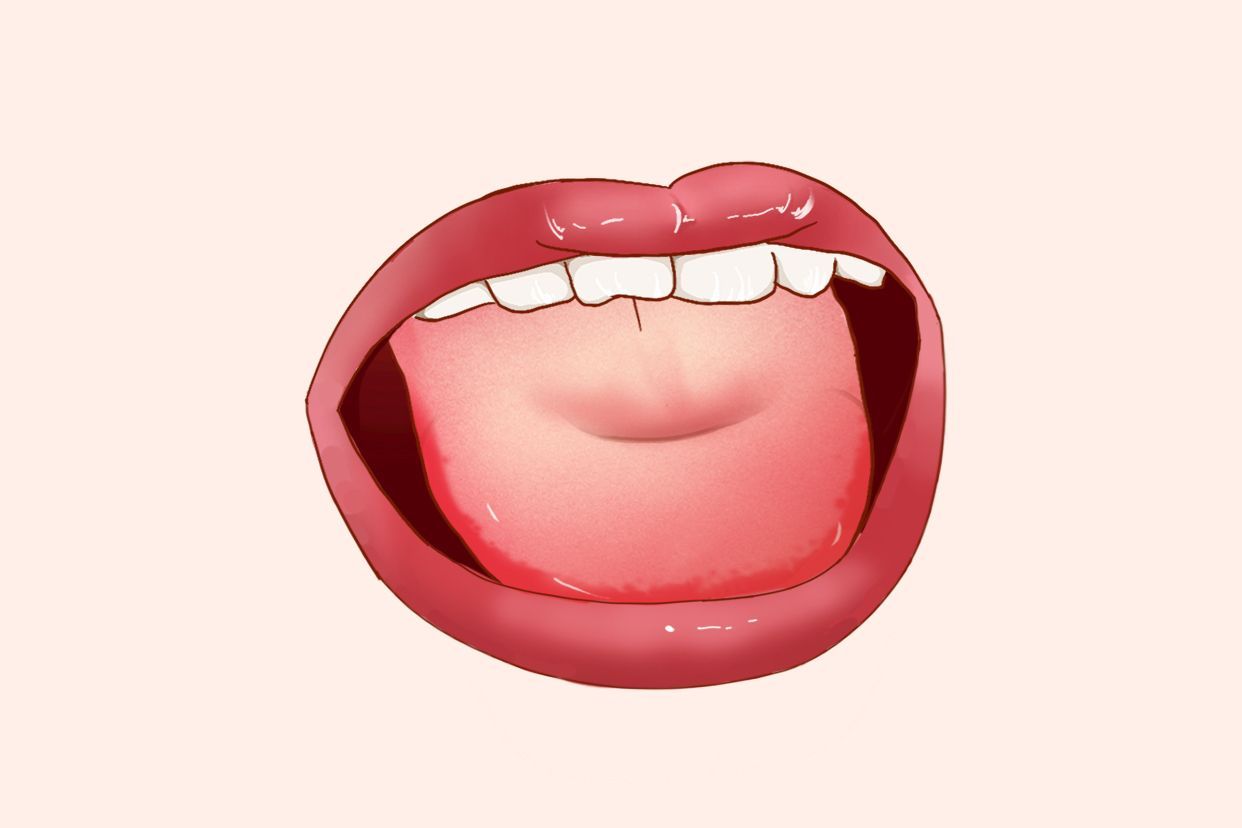 痿软舌图片 痿软舌多见于
