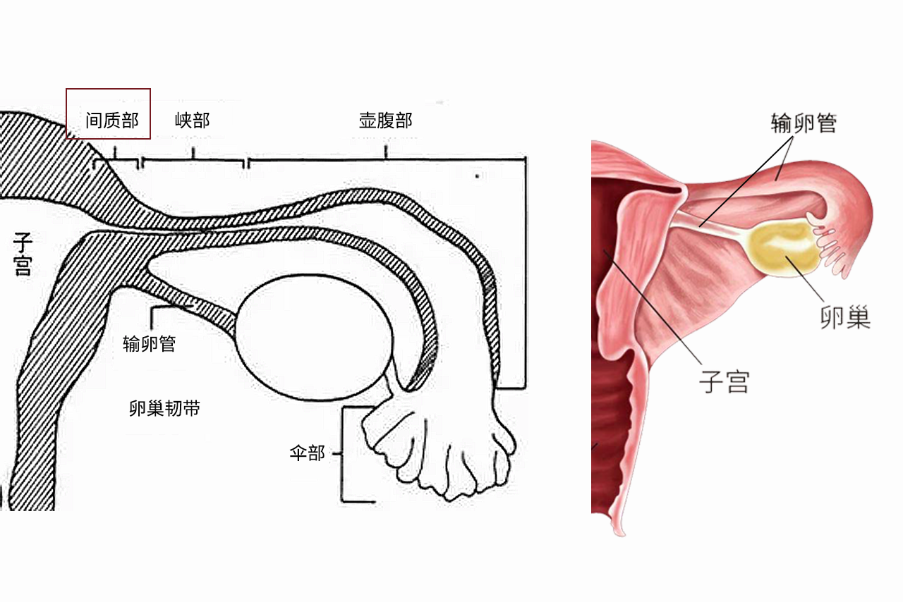 输卵管间质部图片（输卵管间质部是什么位置）