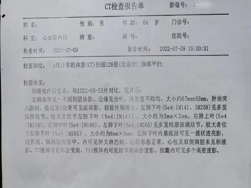 一位无法手术只能化疗的64岁肺鳞癌晚期患者治疗过程